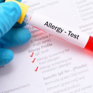 Different Reasons You Might Visit an Allergist