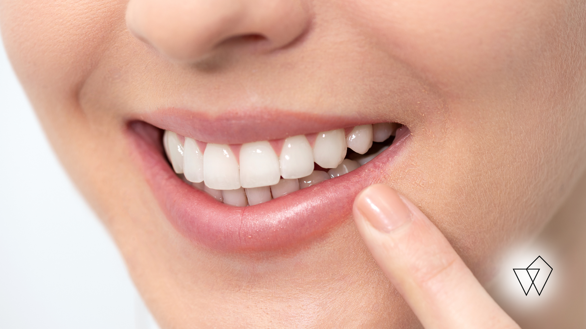 Close-up of a person's smiling mouth, showing bright white teeth. A finger points towards the teeth.