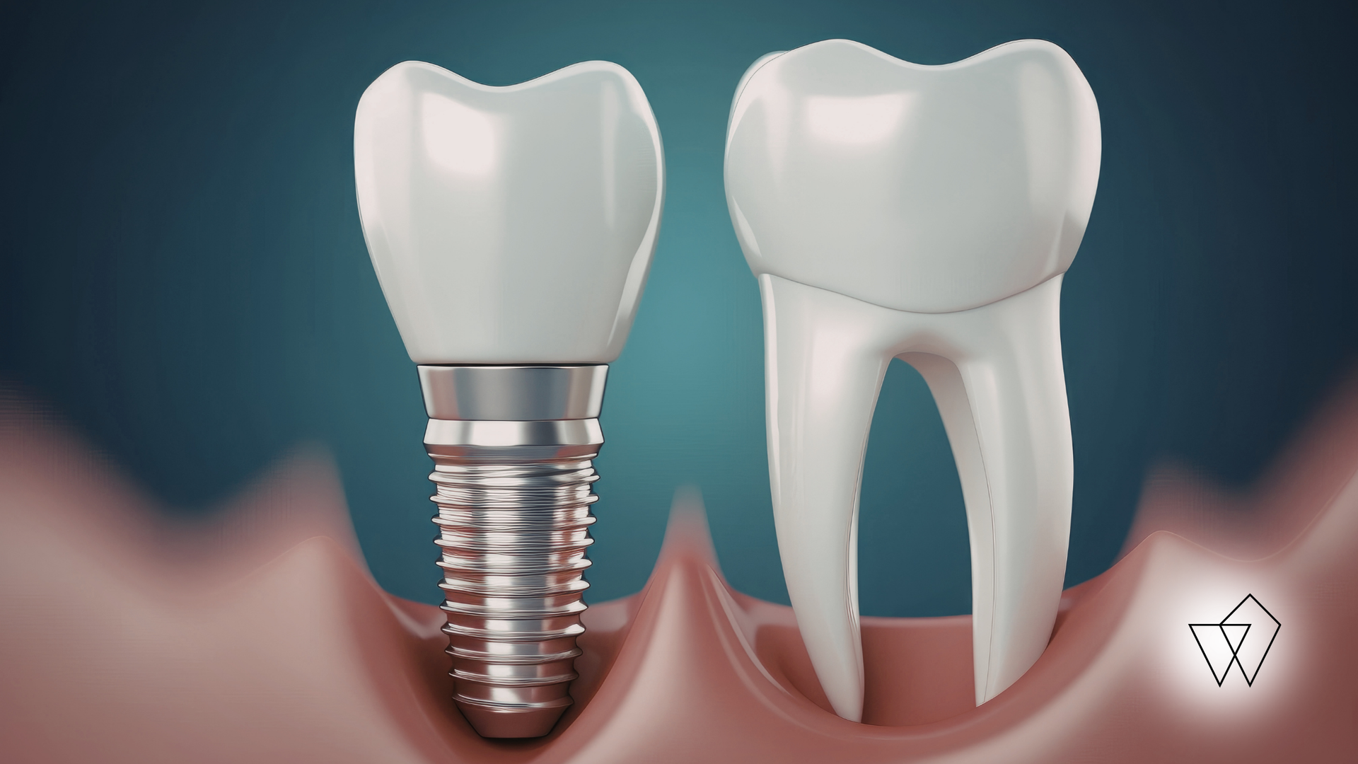 Dental implant beside a natural tooth in pink gums, showing a side-by-side comparison.