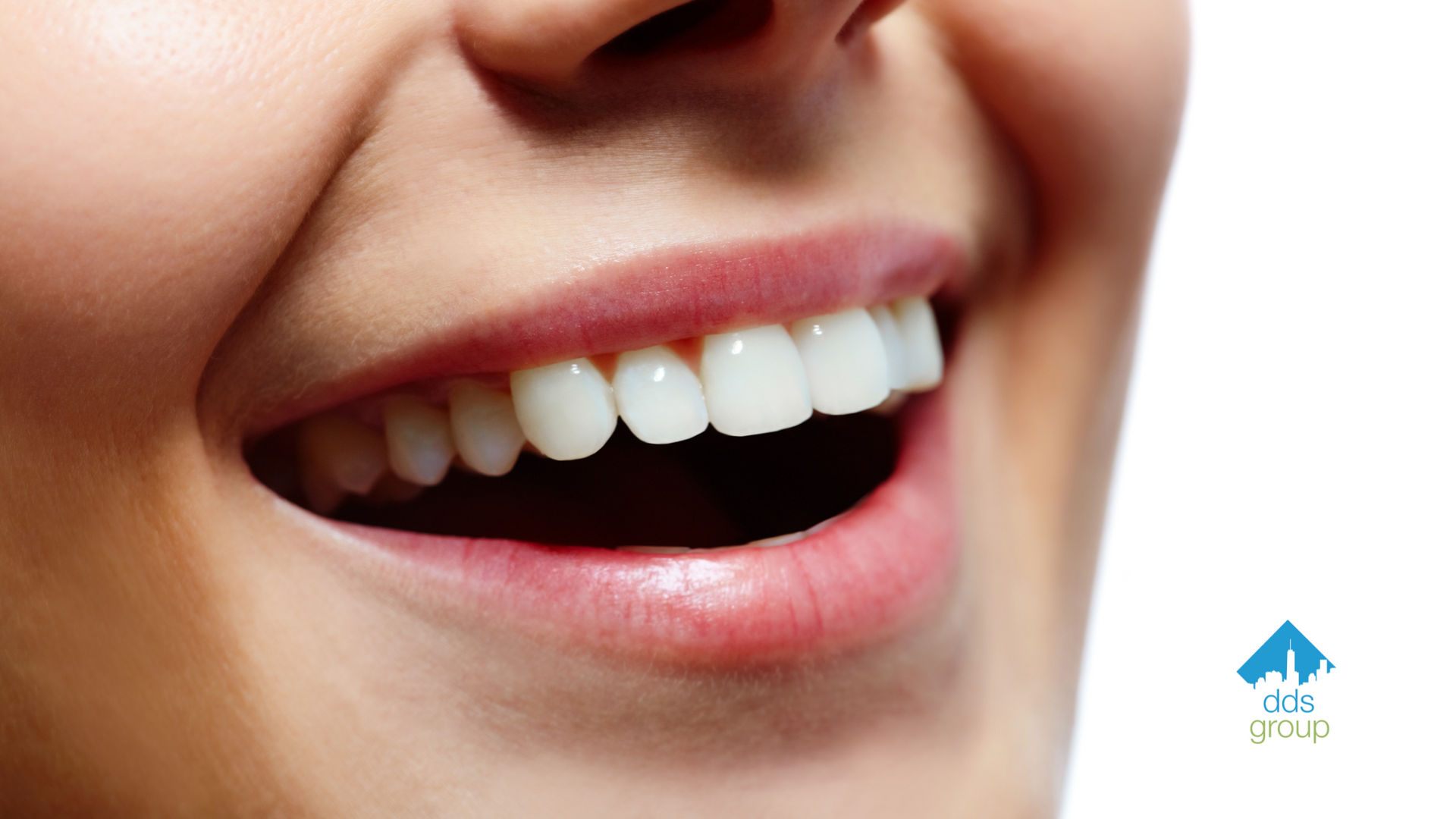 A close up of a woman 's smile with white teeth