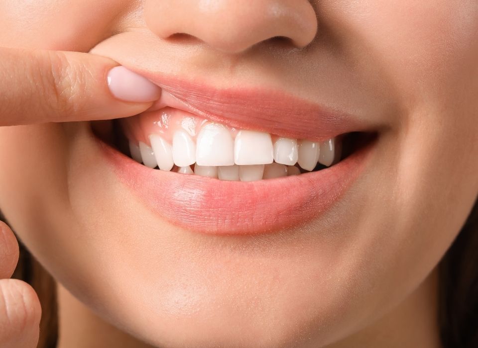 Close-up of a person's smiling mouth showing bright white teeth. Finger touching the gums. Pink lips.
