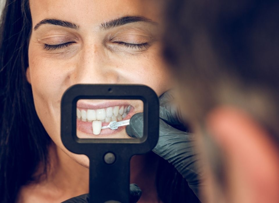 Woman having teeth shade matched by dentist using a shade guide.