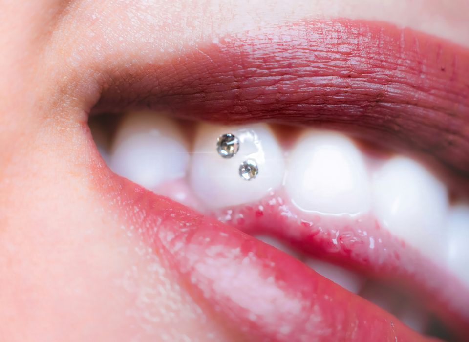 Close-up of a smiling mouth with two small crystal tooth gems on a white tooth, dark lipstick.