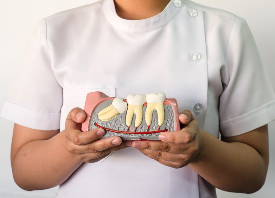 X-ray of a skull with inflamed wisdom teeth highlighted in red.