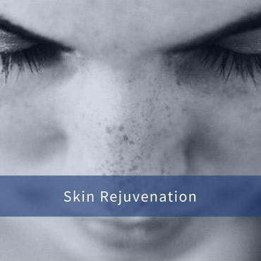 skin rejuvenation image