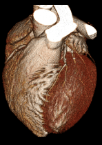 3D Heart Scan