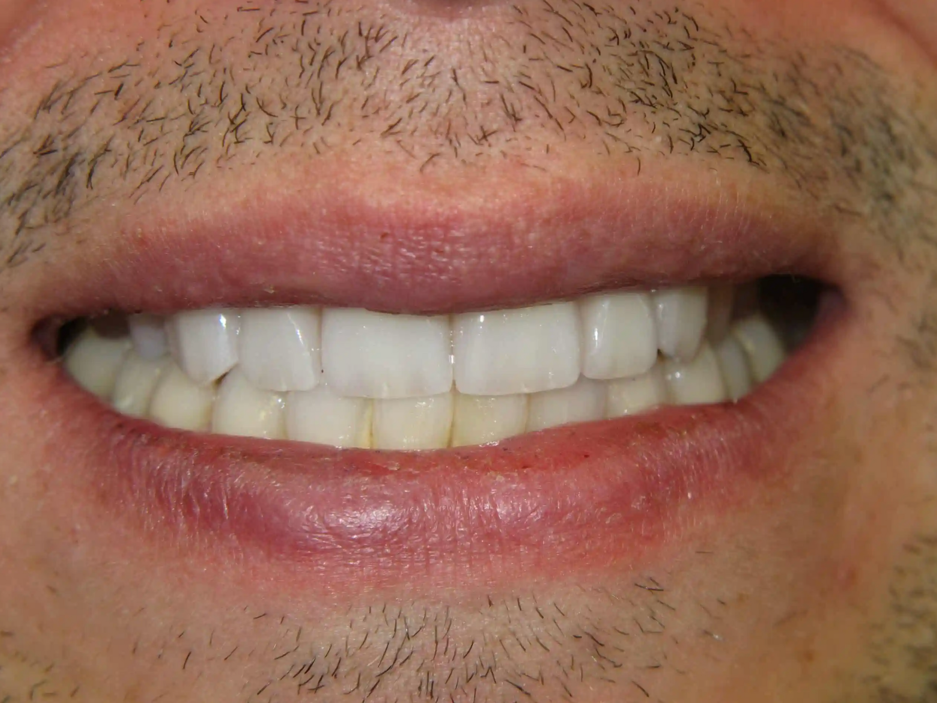 A close up of a man 's mouth with a beard and white teeth.