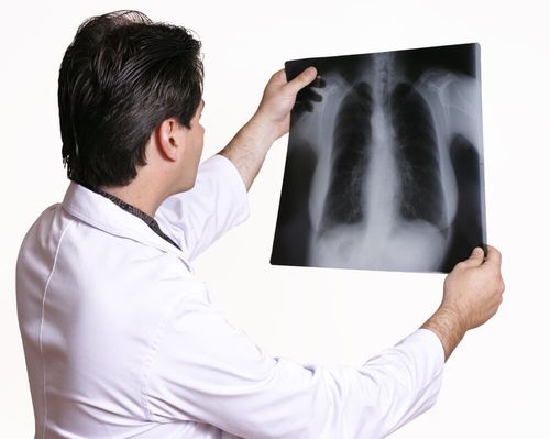 Doctor reviewing x-ray