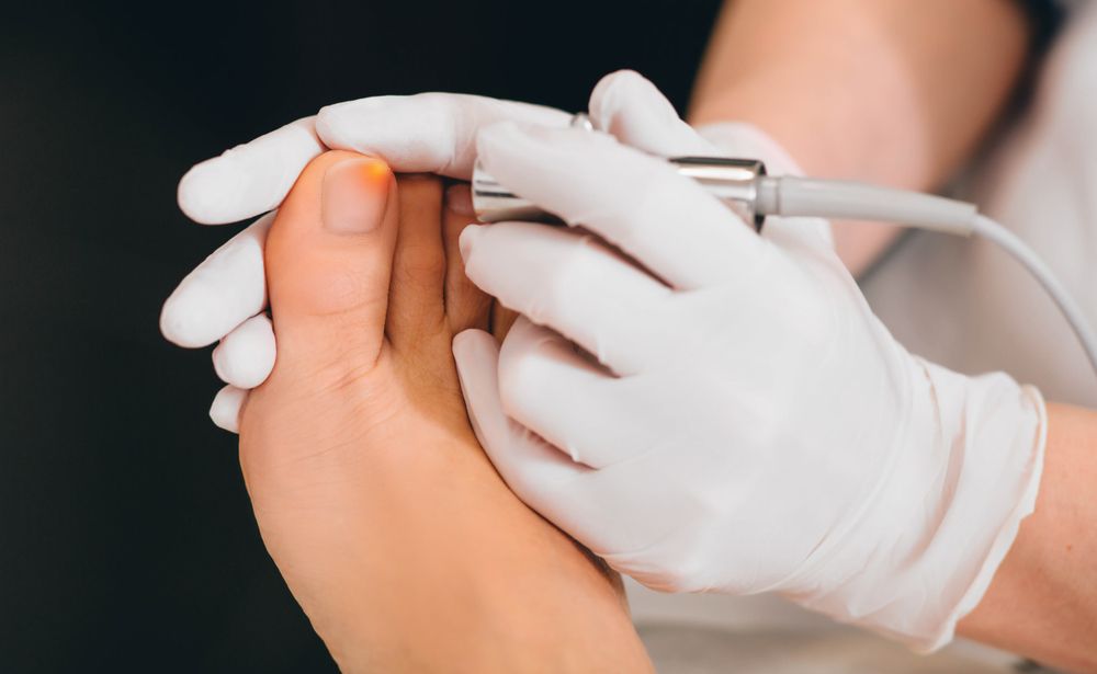 Patient Receiving Laser Treatment on Toenail, Close-up — General Foot & Nail Clinic in Forster, NSW