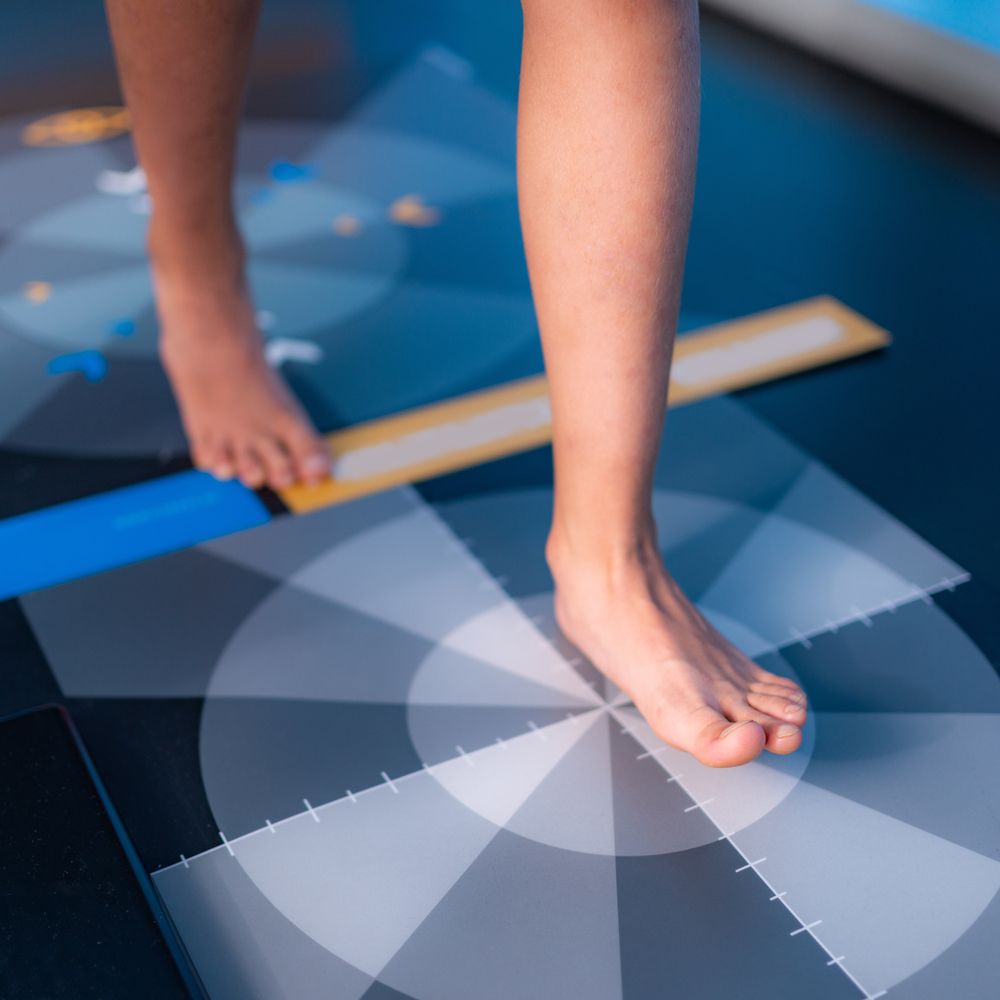 Baropodometry, Gait Analysis Using a Foot Plate in Anthropometry — Providing Diabetes Foot Assessments in Forster, NSW