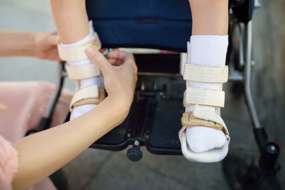 Mother Puts on Her Daughter Legs Orthosis — Providing Diabetes Foot Assessments in Forster, NSW