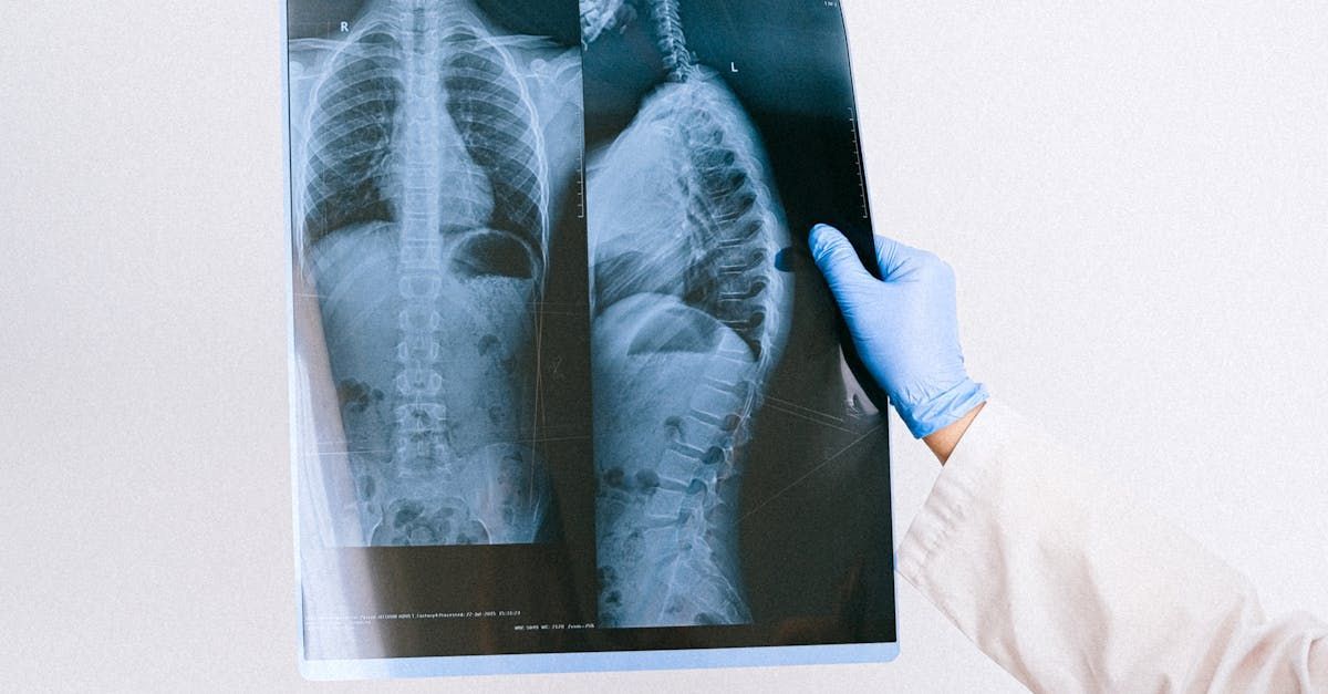 A doctor is holding an x-ray of a person 's chest.