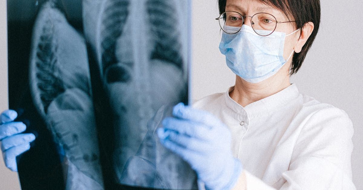 A doctor wearing a mask and gloves is looking at an x-ray.