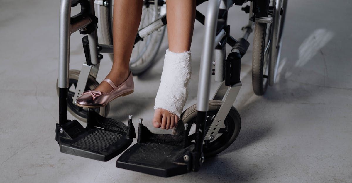 A woman with a cast on her foot is sitting in a wheelchair.