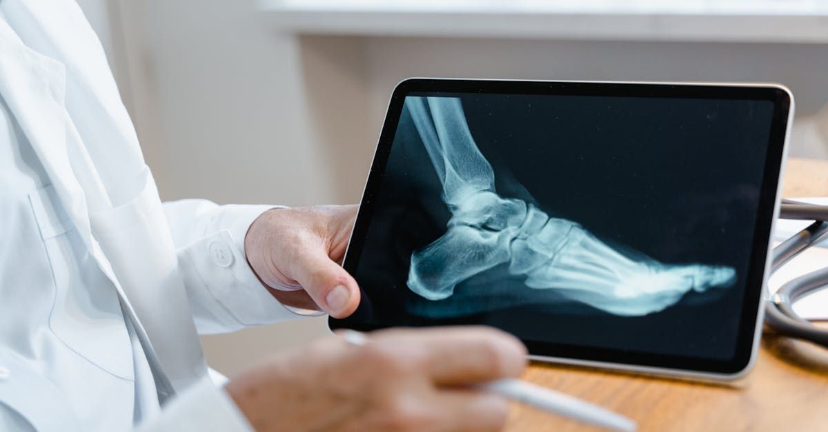 A doctor is looking at an x-ray of a foot on a tablet.