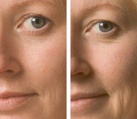 OXYGEN FACIALS