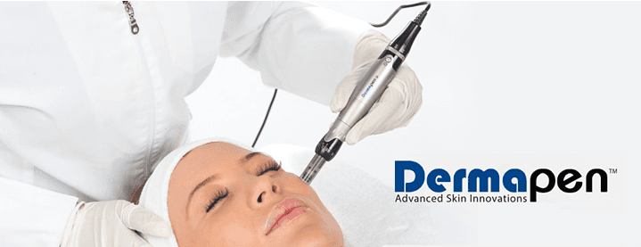 Derma Pen-Skin needling treatment
