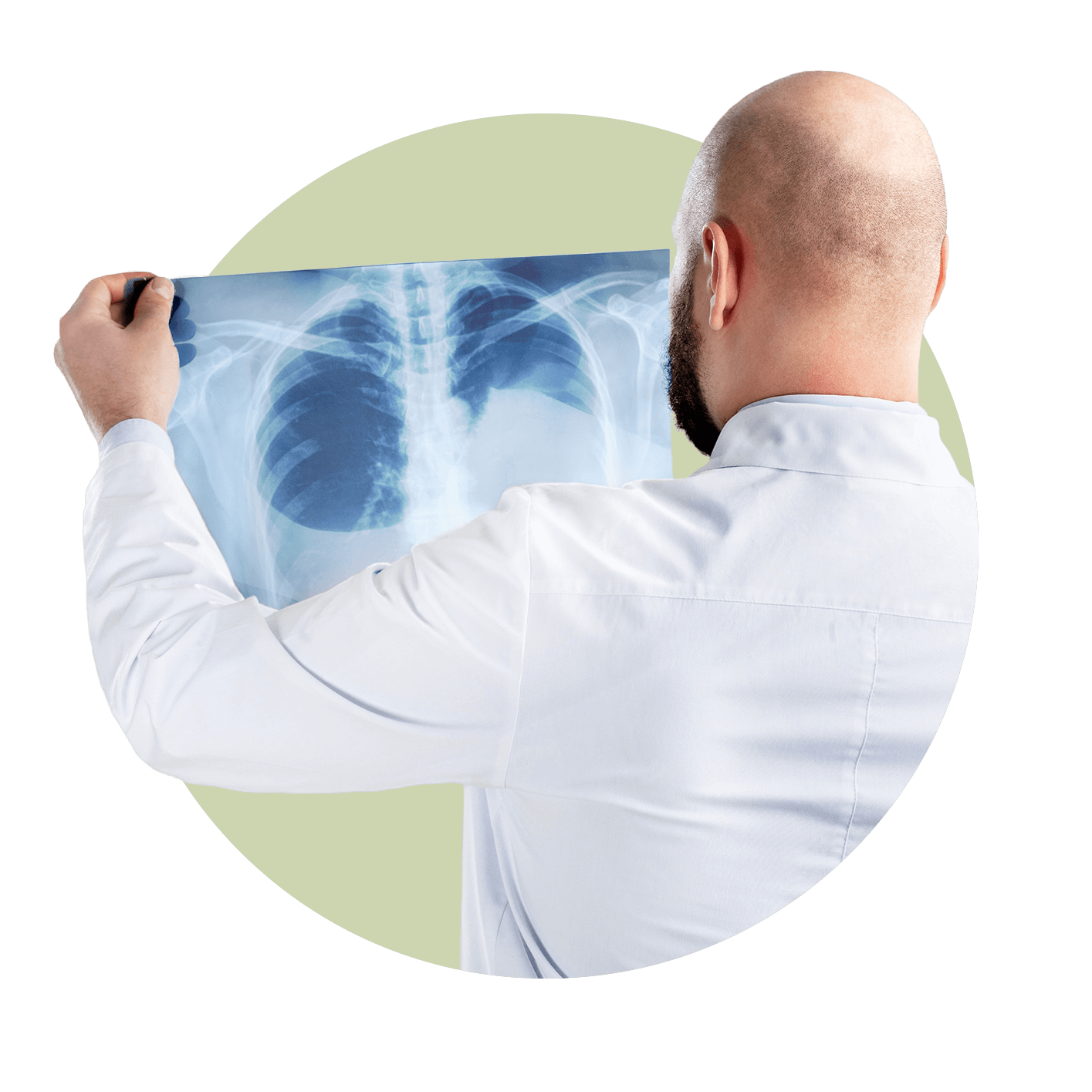 Man with beard with back facing camera looking at a chest X-ray