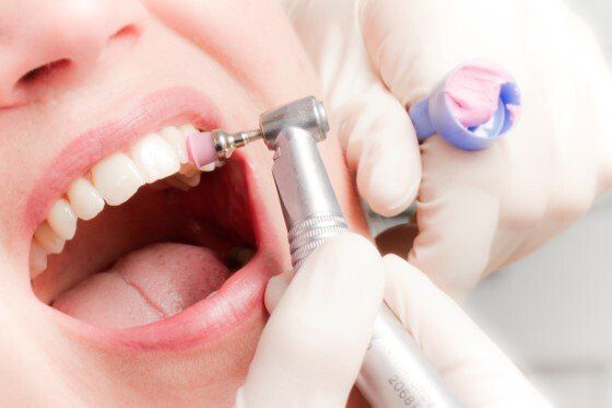 Die professionelle Zahnreinigung (PZR)