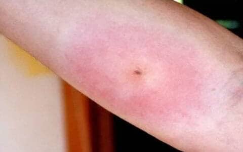 CASA JARDÍN INDUSTRIA - Que hacer ante una picadura de alacrán CASA JARDÍN INDUSTRIA - Que hacer ante una picadura de alacrán