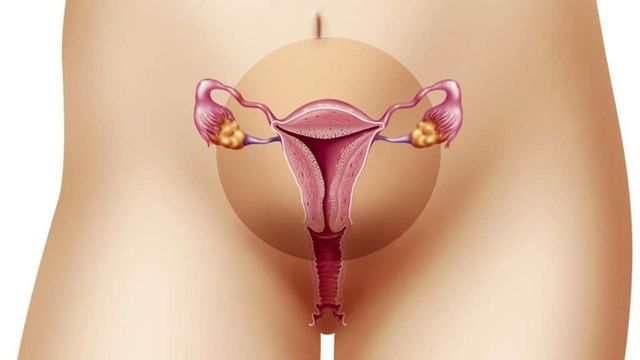 Endometriose - o que causa no corpo?