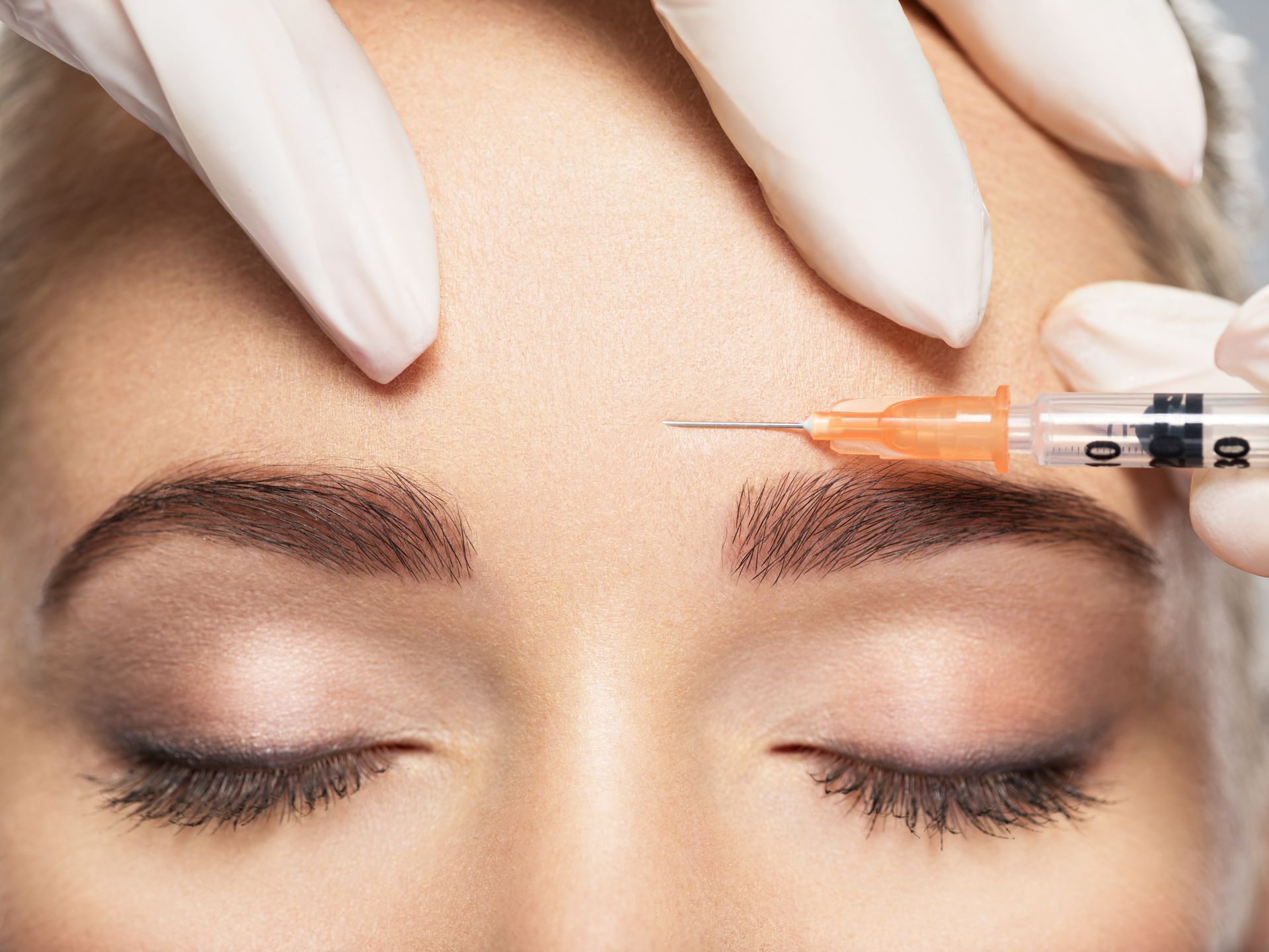 Cosmetic syringe injecting filler into a woman’s forehead, eyes closed, with gloved hands visible