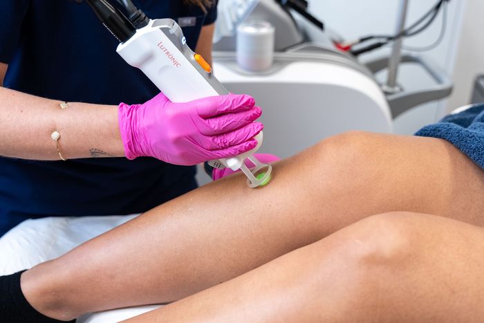 Eine Frau lächelt , während sie einen Laser auf ihr Gesicht erhält