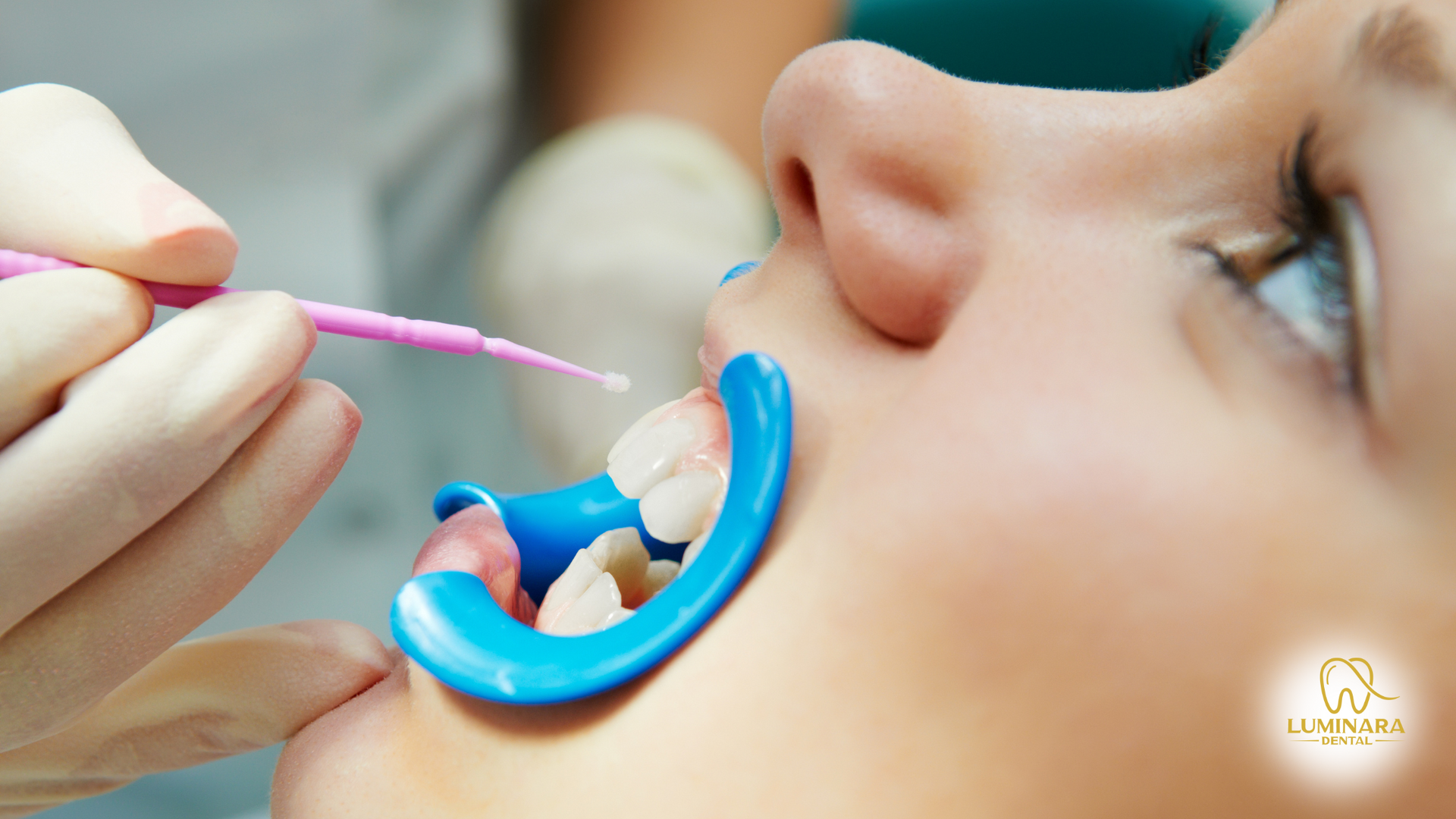A woman is getting her teeth examined by a dentist.