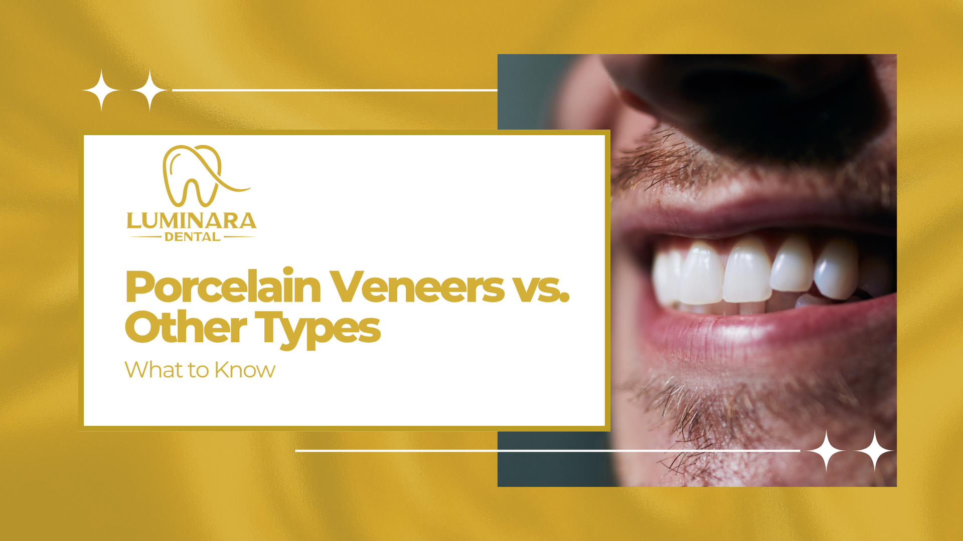 Porcelain veneers vs. other types what to know