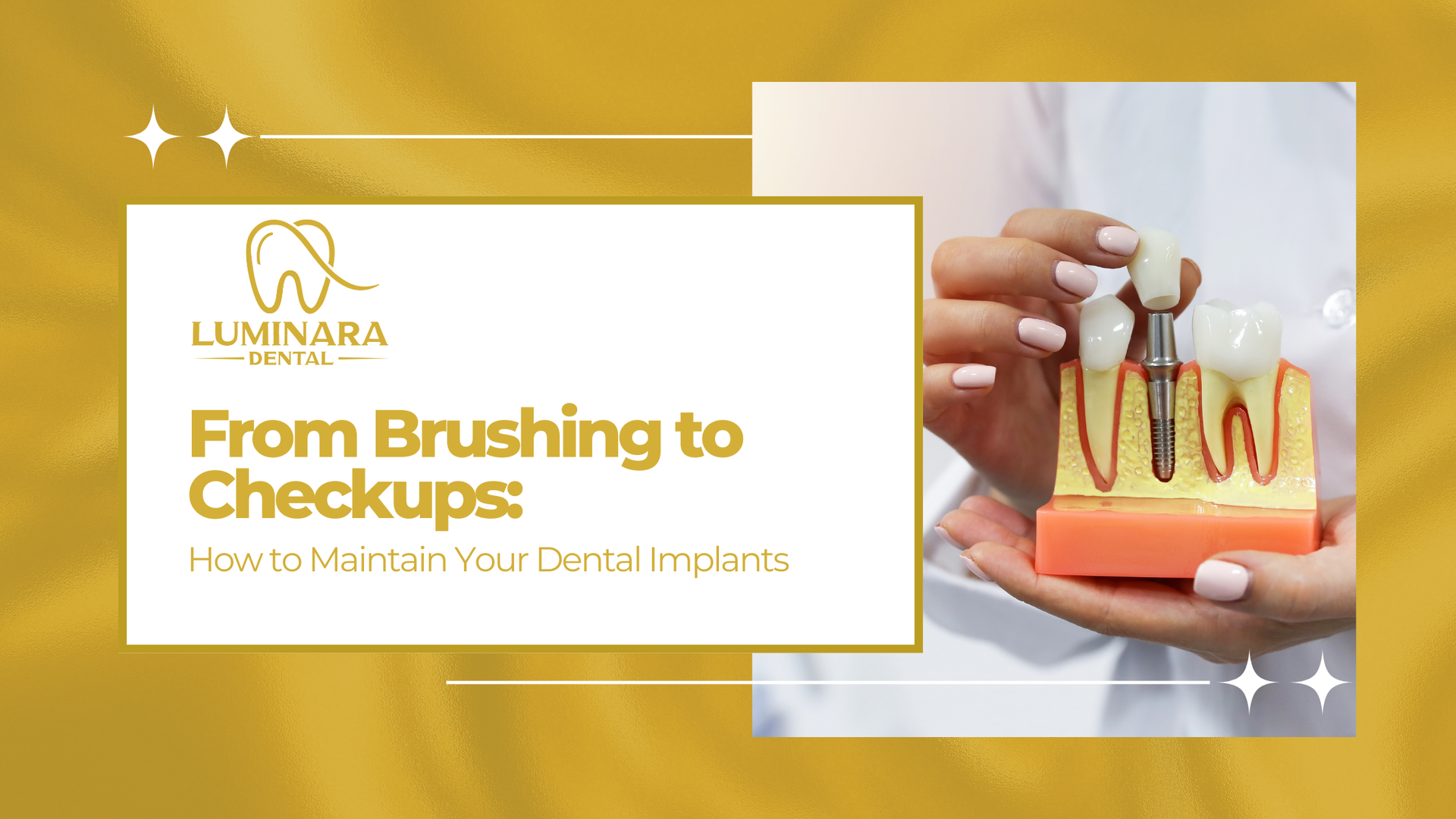 A person is holding a model of a dental implant in their hand.