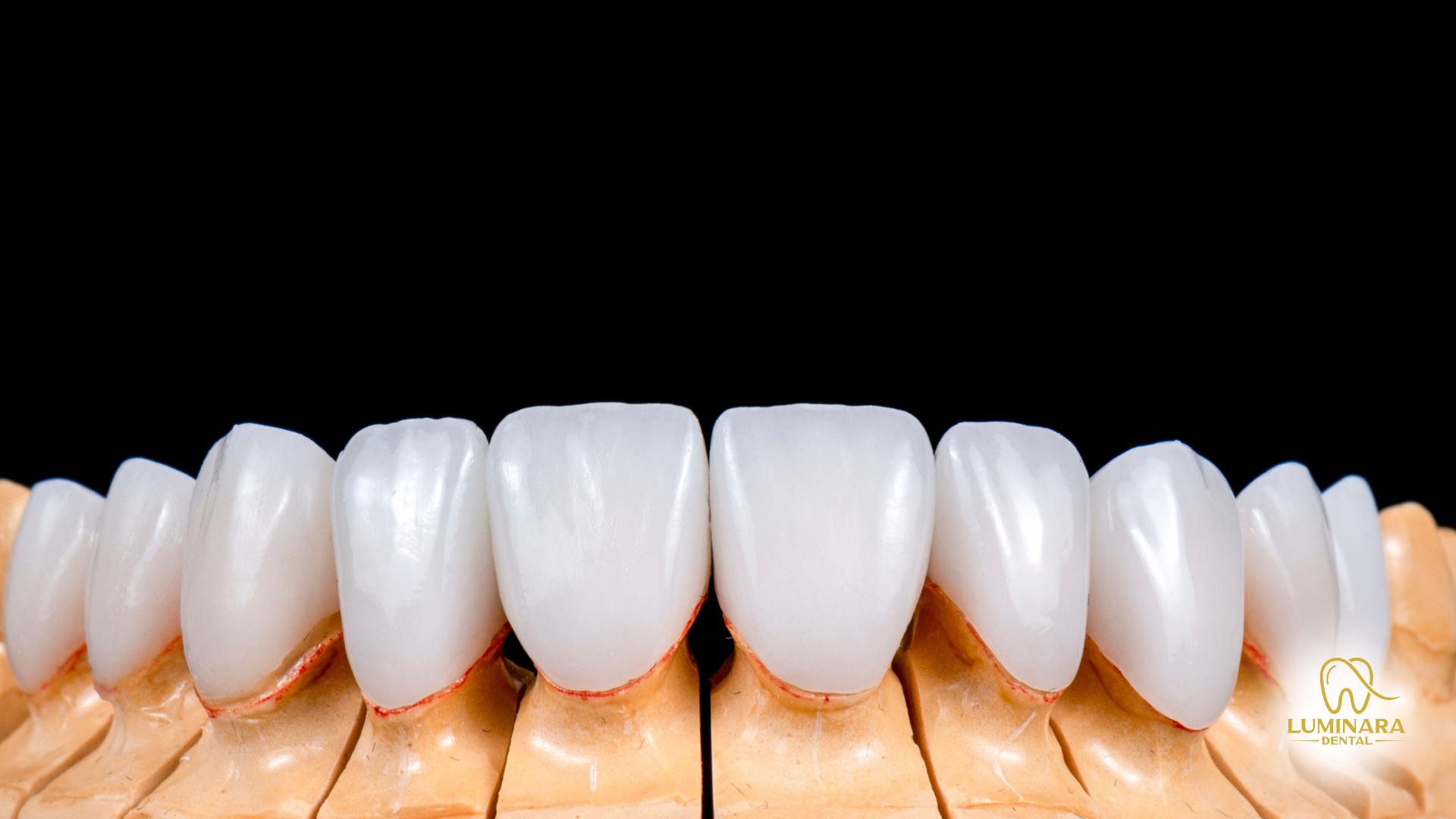 Close-up of perfectly white dental veneers on a model against a black background.