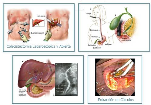 DIGECLINIC / DR. MICHAEL VITALE - Clínica de cirugía digestiva
