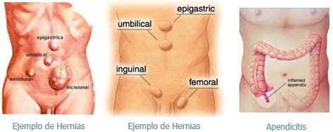 DIGECLINIC / DR. MICHAEL VITALE - Enfermedades del aparato digestivo