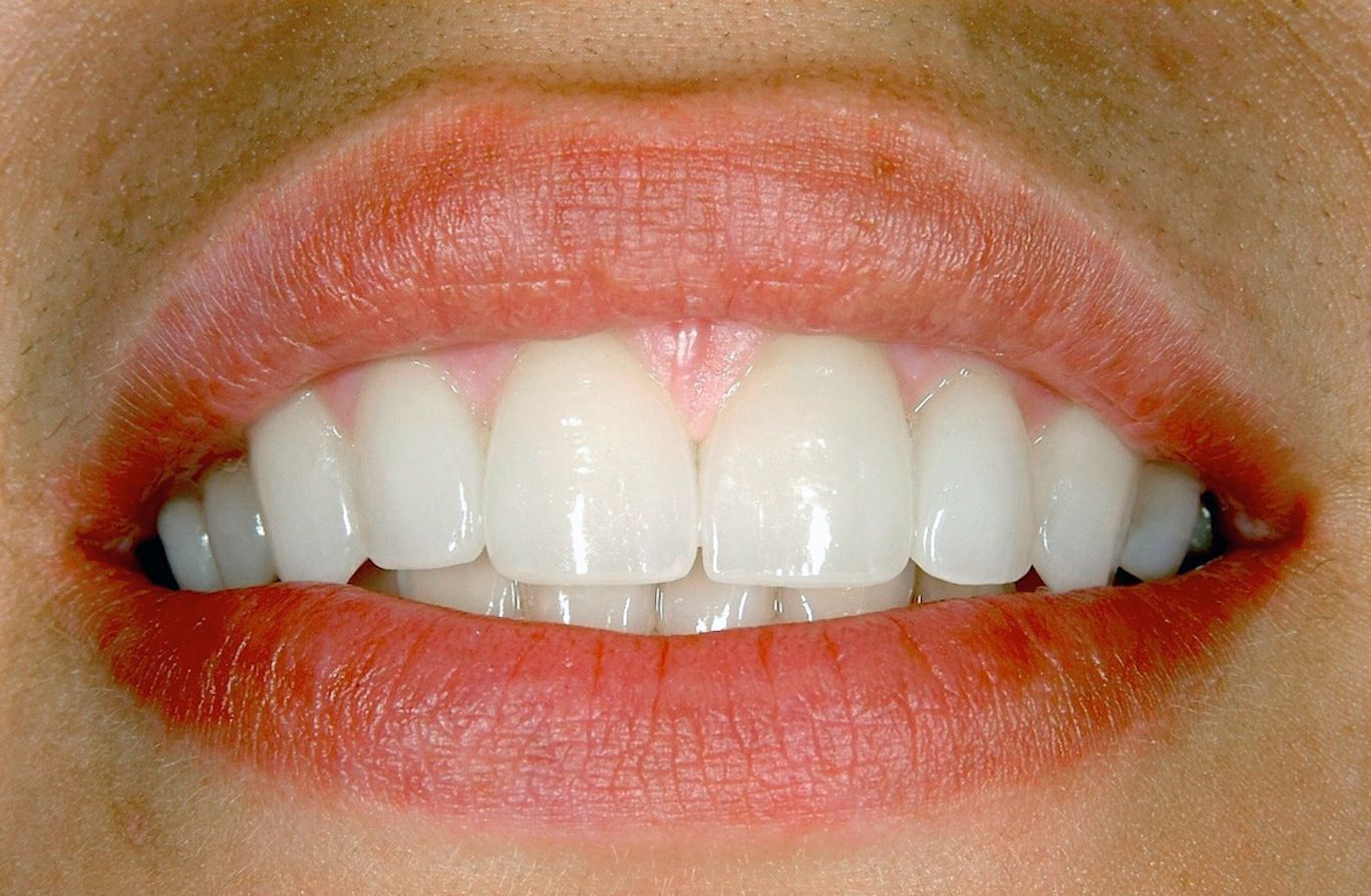 A close up of a woman 's mouth with white teeth and red lips.