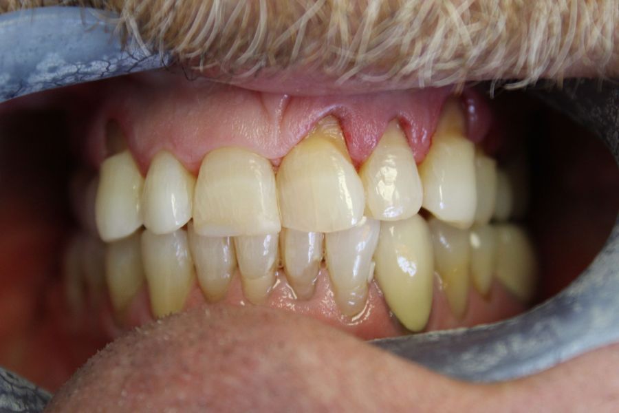 A close up of a man 's teeth with a beard.