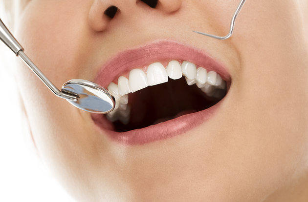 A woman is getting her teeth examined by a dentist