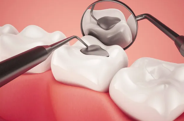 A close up of a tooth being examined by a dentist.