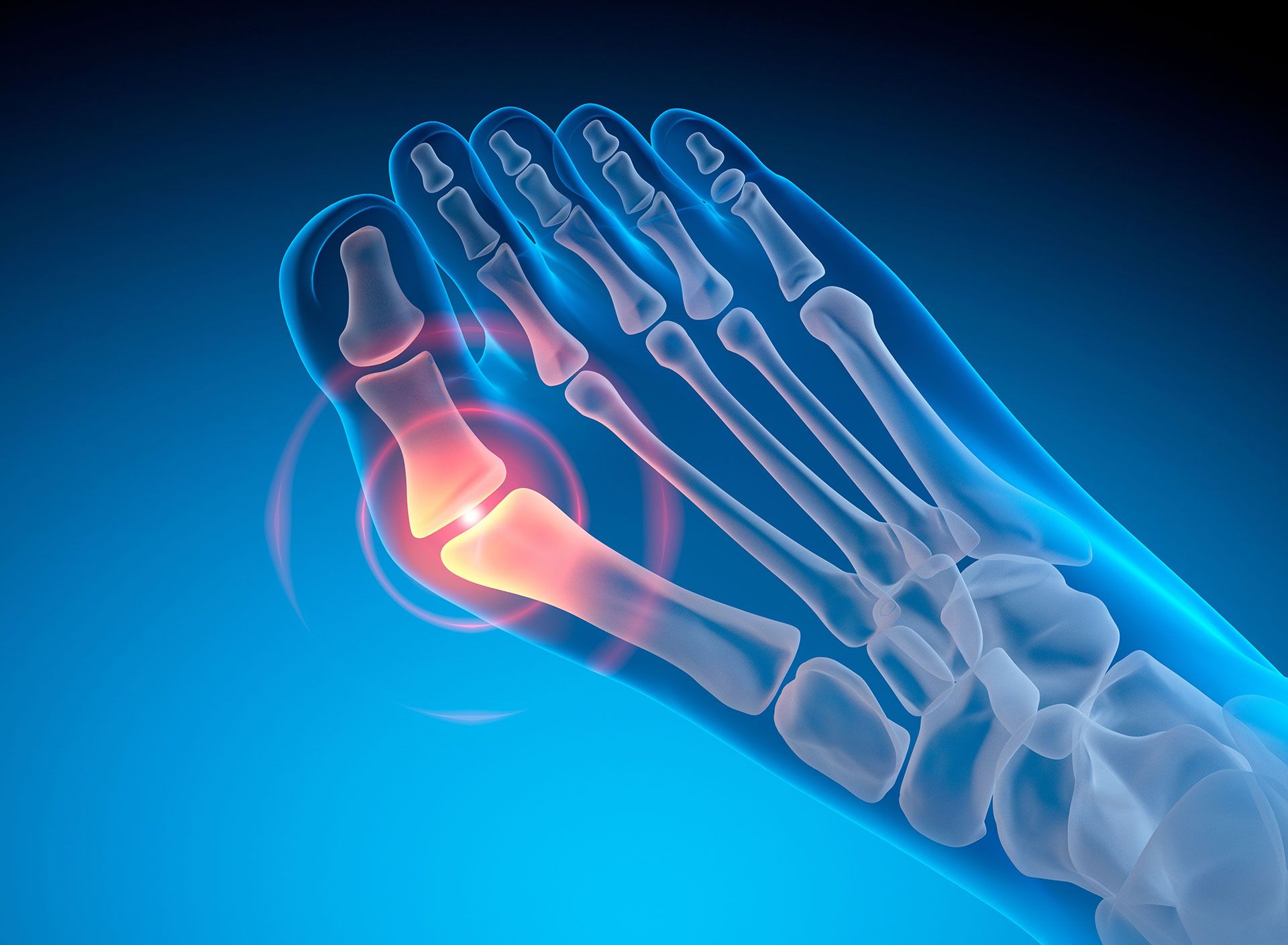 A close up of a person 's foot with a large bump on it.