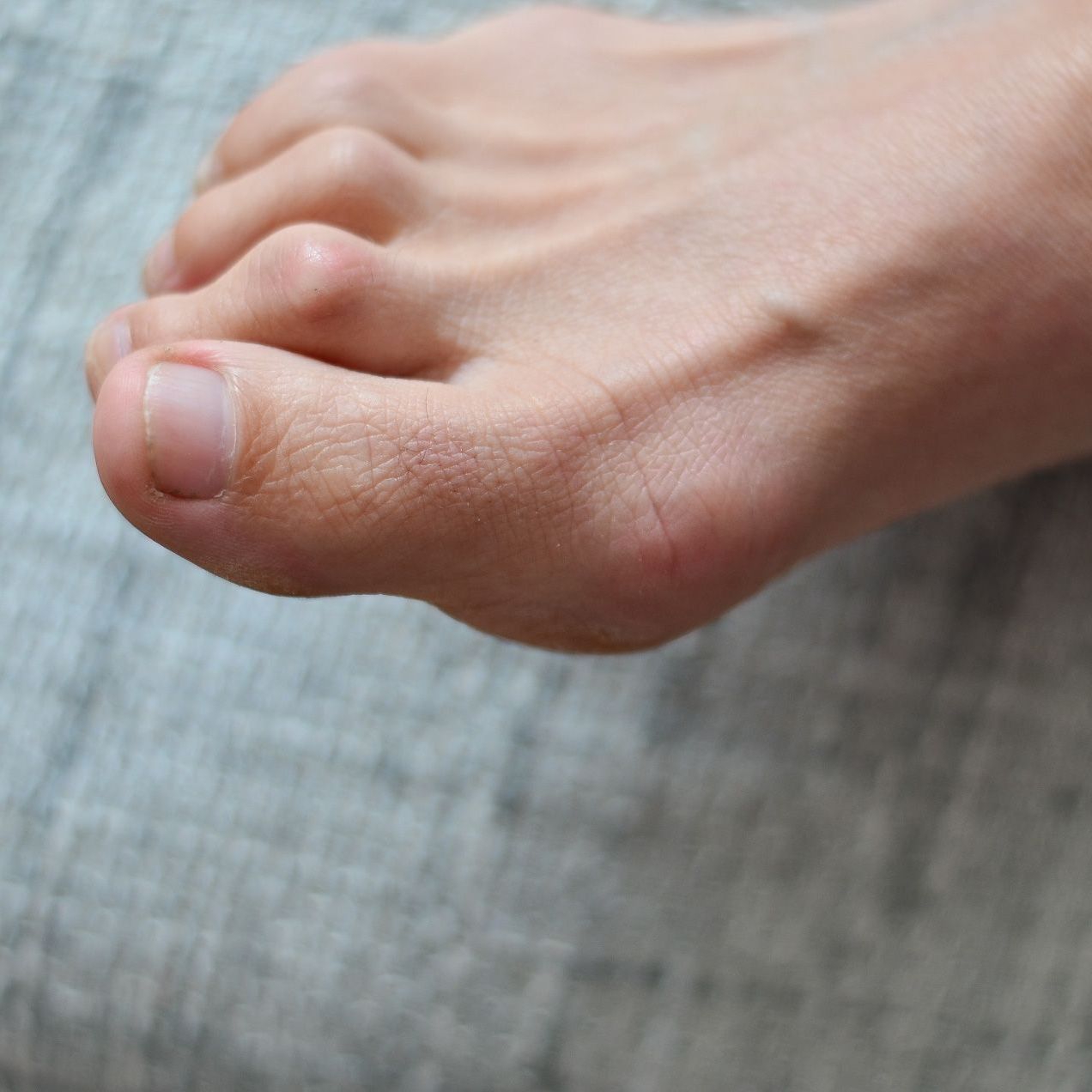 A person is holding their foot in pain.