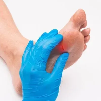 A person wearing blue gloves is examining a person 's foot.