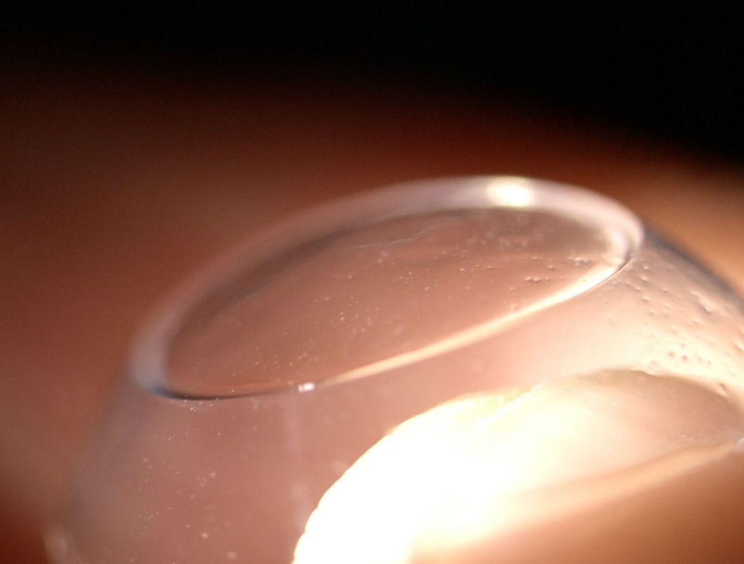 Lenti per cheratocono morbide con intarsio