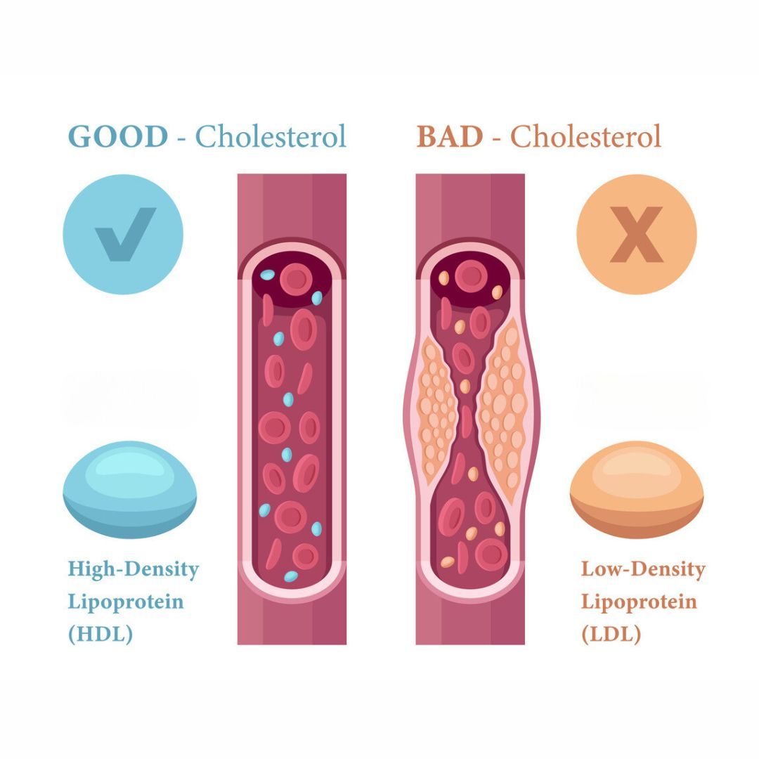 HDL und LDL Cholesterin