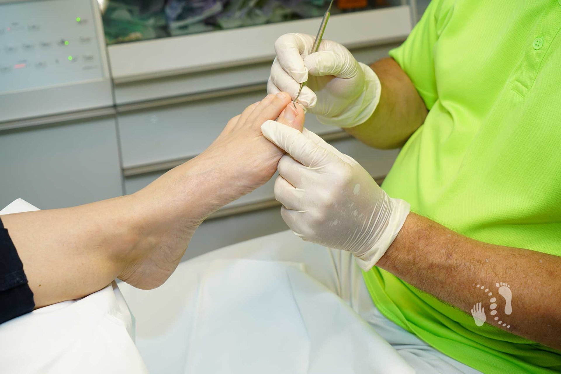 Sondierung mit Sondierhaken - Podologie Kay Promnitz