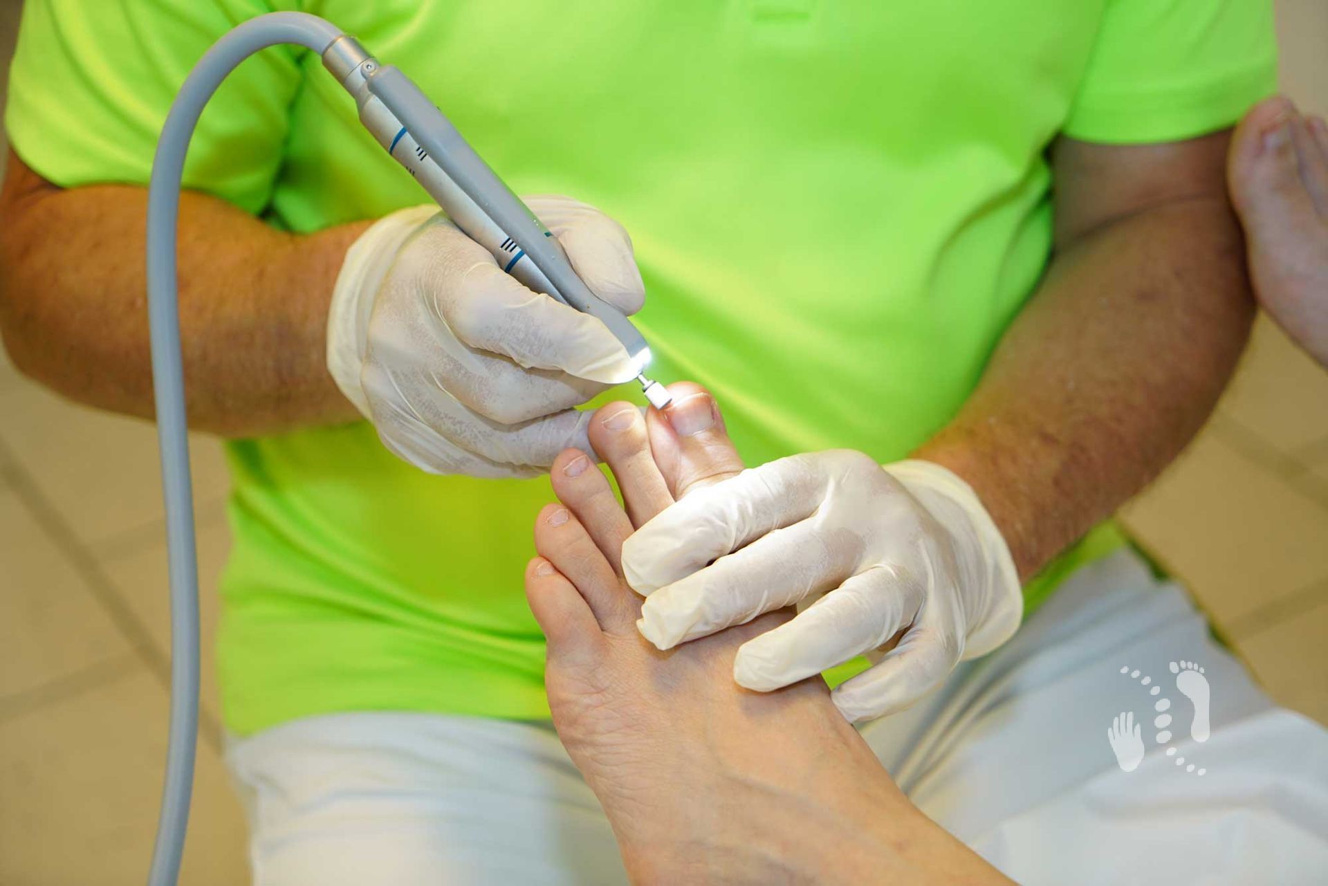 Nagelglättung mit Diamantschleifkörper - Podologie Kay Promnitz