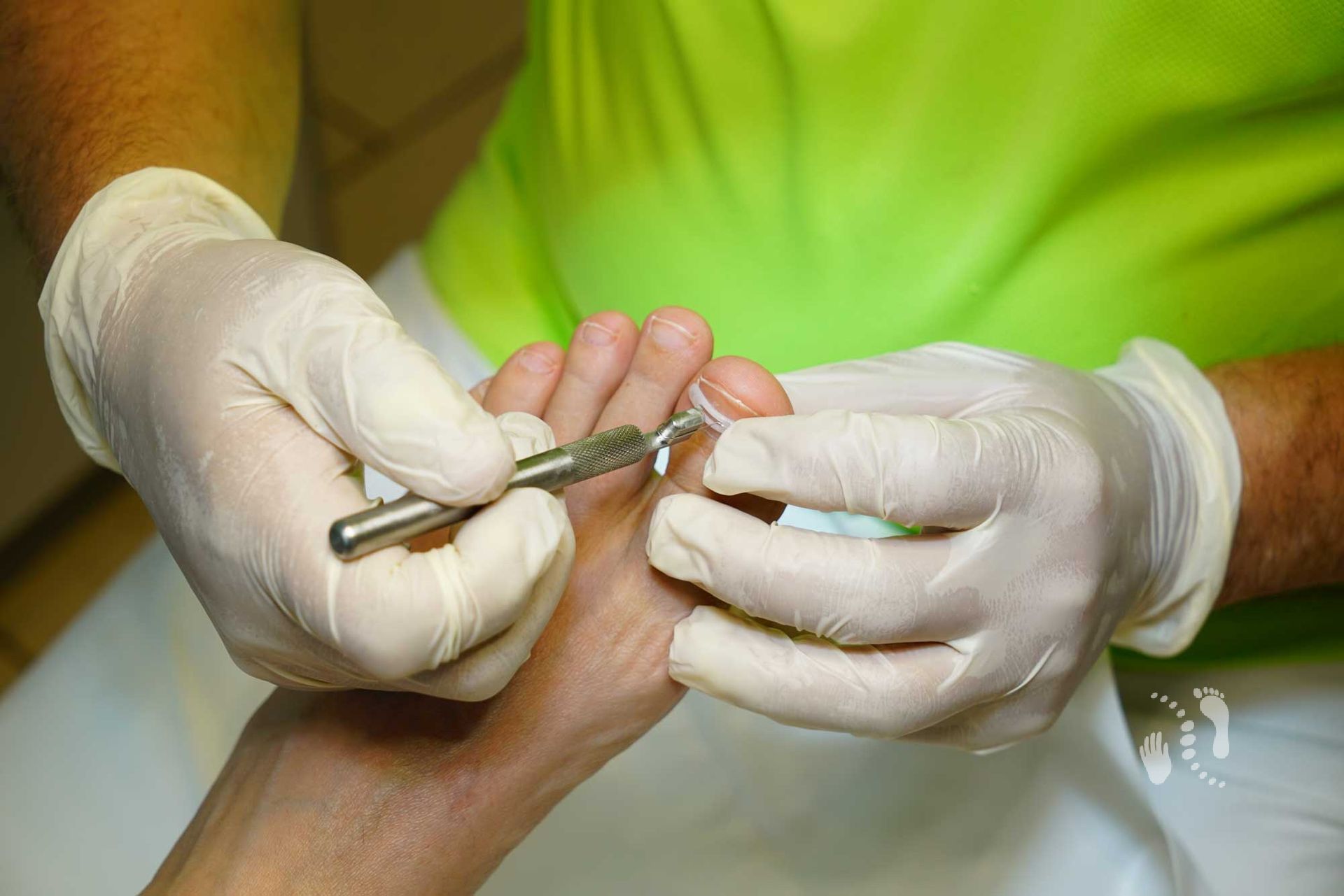 Anlegen einer Nagelspange - Podologie Kay Promnitz