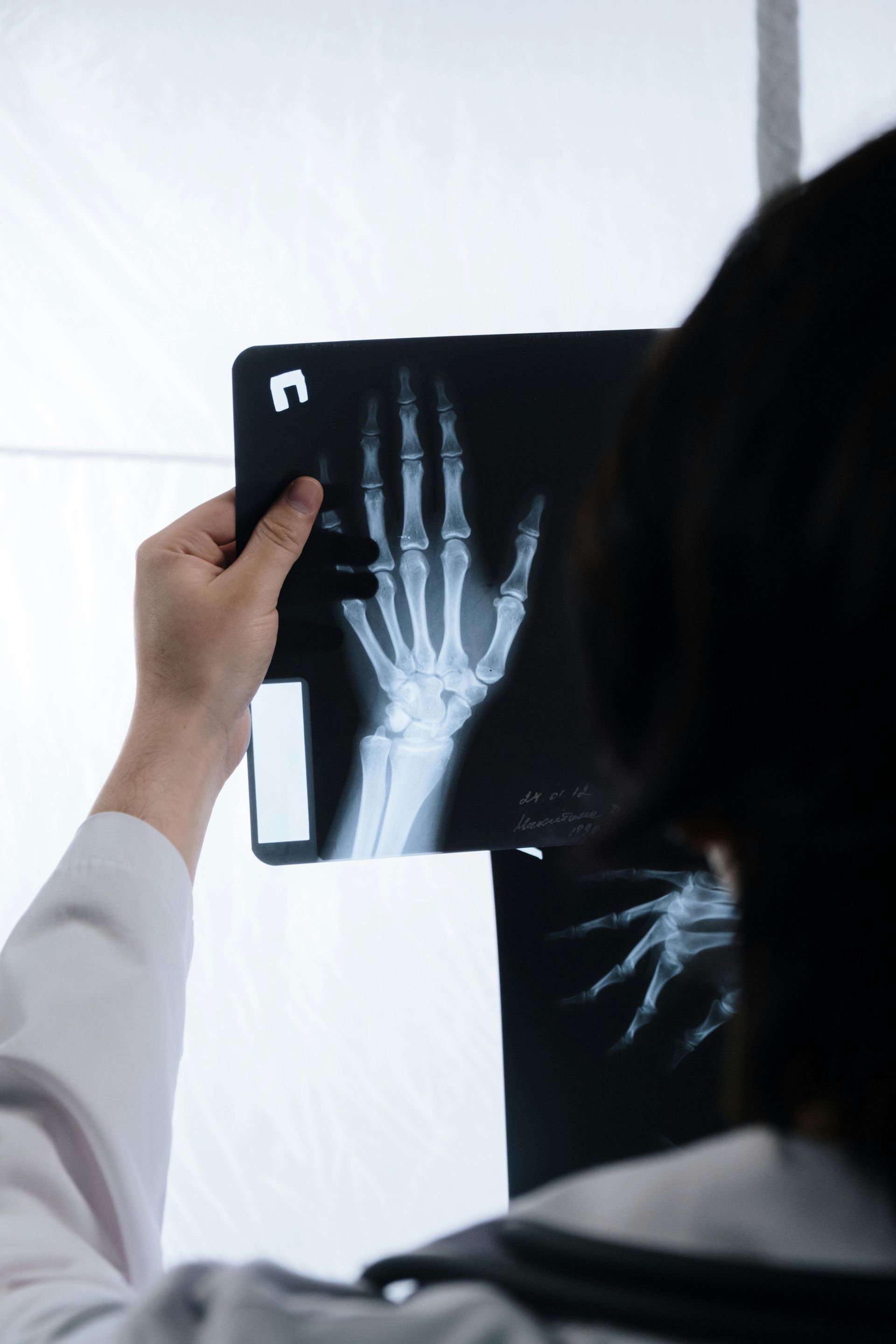 A person holding an X-ray film of a human hand up to a light source.
