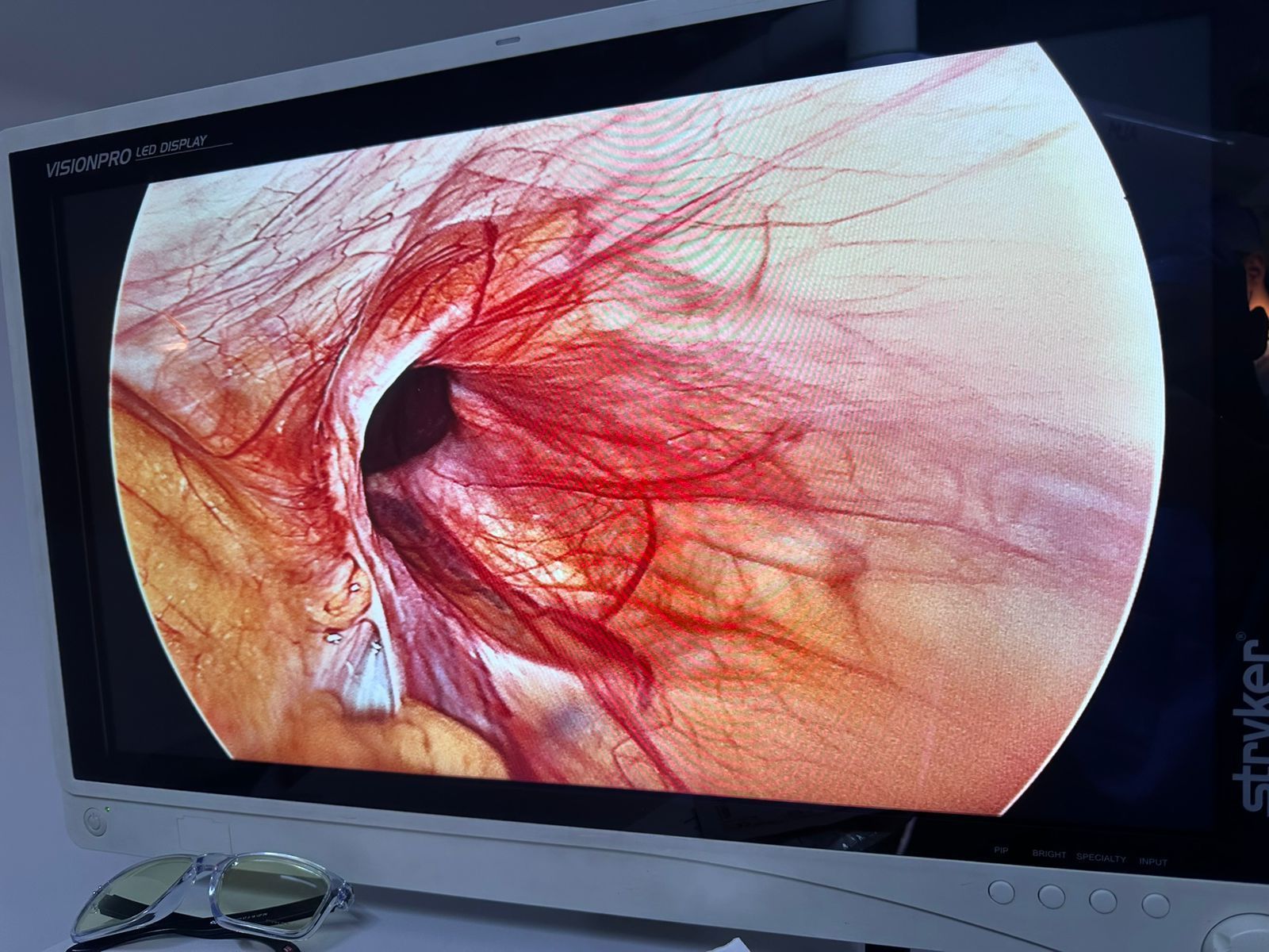 Equipo para cirugía laparoscópica