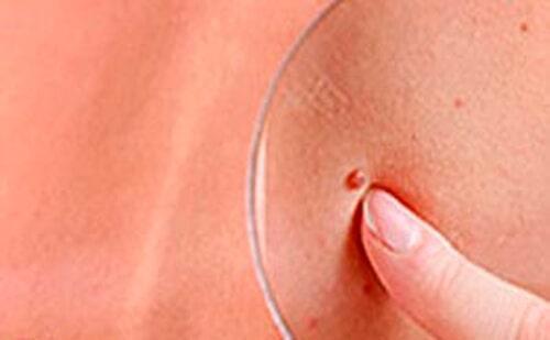 DR NOÉ NÁJERA GONZÁLEZ - Agenda una cita