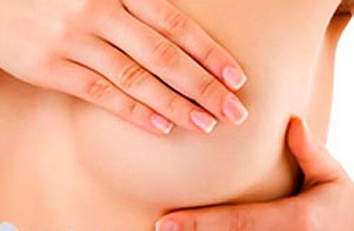 DR NOÉ NÁJERA GONZÁLEZ - Cáncer de mama