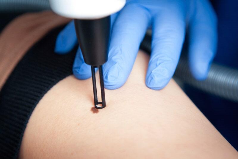 DR NOÉ NÁJERA GONZÁLEZ - DIAGNÓSTICO Y TRATAMIENTO